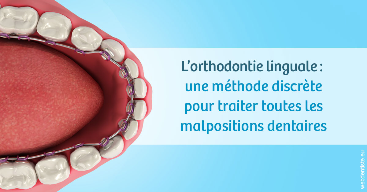 https://selarl-centre-dentaire-arceaux.chirurgiens-dentistes.fr/L'orthodontie linguale 1