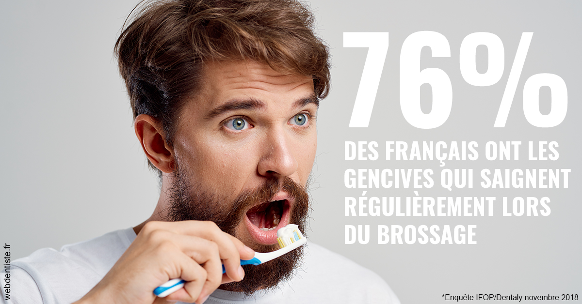 https://selarl-centre-dentaire-arceaux.chirurgiens-dentistes.fr/76% des Français 2