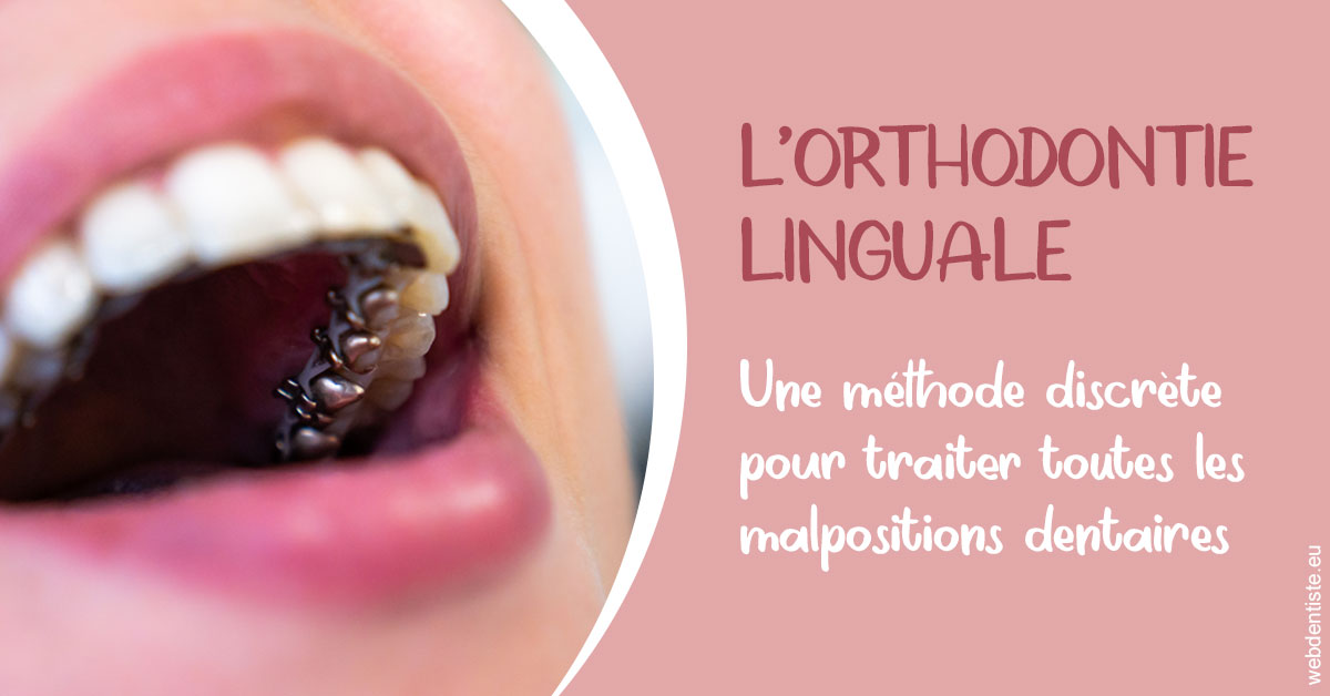 https://selarl-centre-dentaire-arceaux.chirurgiens-dentistes.fr/L'orthodontie linguale 2