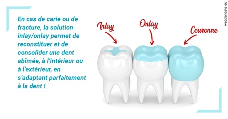https://selarl-centre-dentaire-arceaux.chirurgiens-dentistes.fr/L'INLAY ou l'ONLAY
