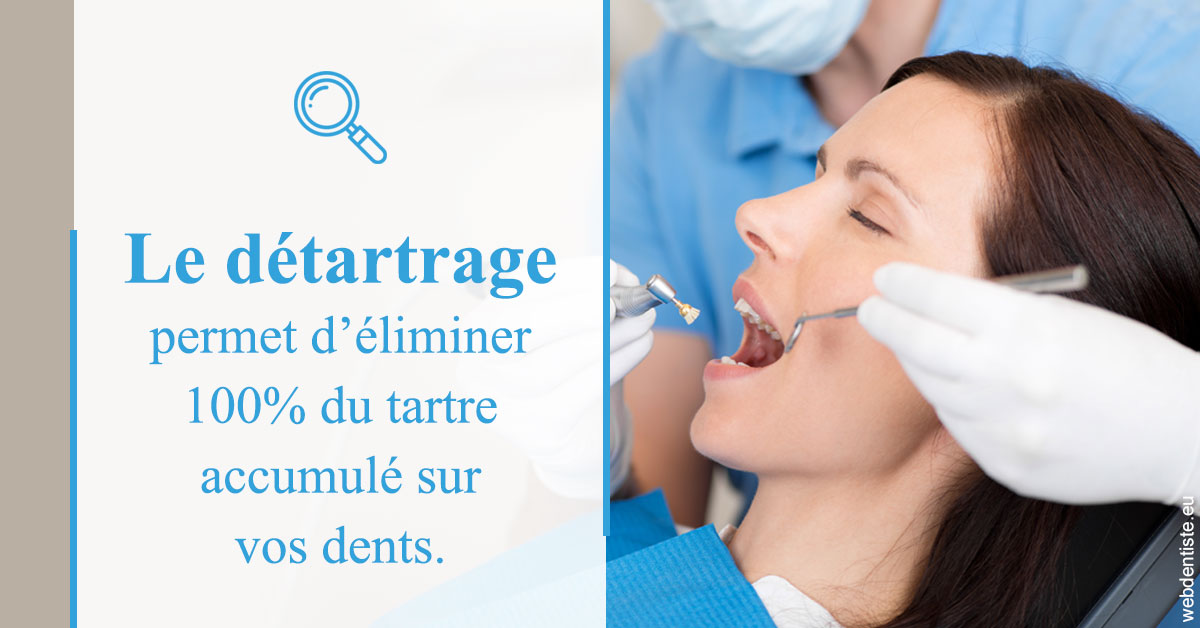 https://selarl-centre-dentaire-arceaux.chirurgiens-dentistes.fr/En quoi consiste le détartrage