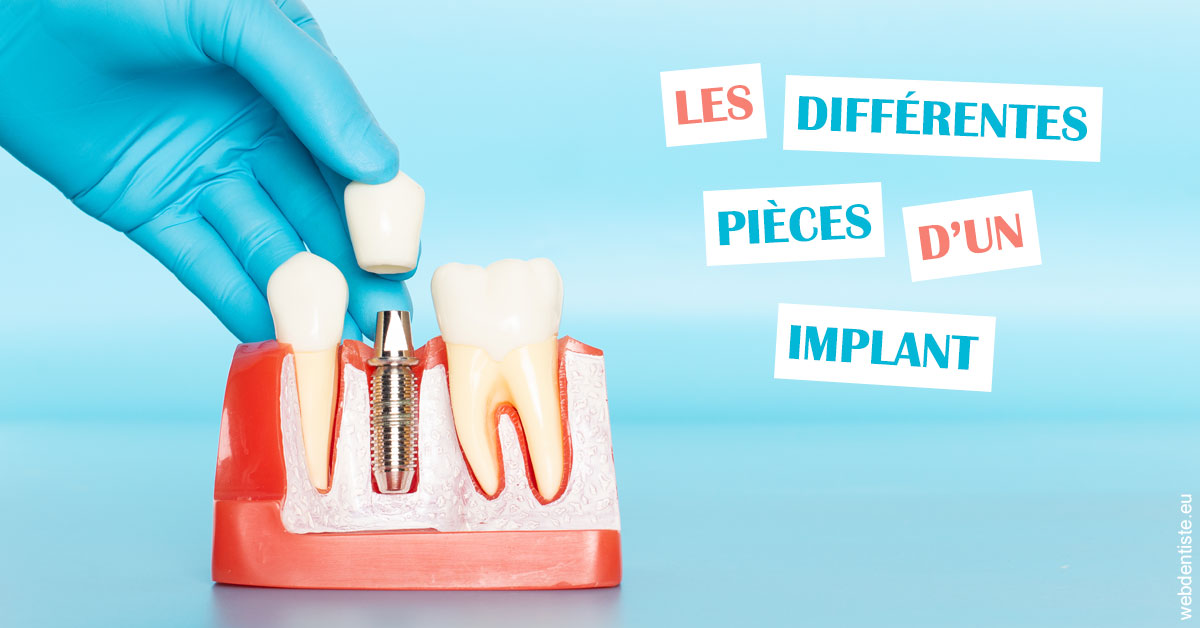 https://selarl-centre-dentaire-arceaux.chirurgiens-dentistes.fr/Les différentes pièces d’un implant 2