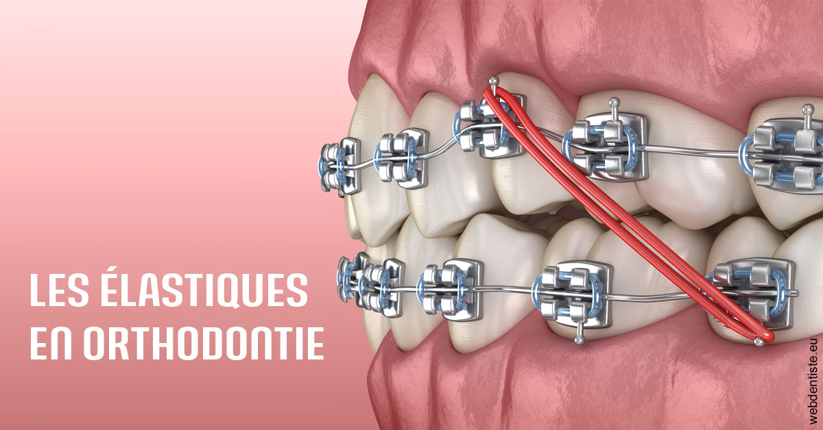 https://selarl-centre-dentaire-arceaux.chirurgiens-dentistes.fr/Elastiques orthodontie 2