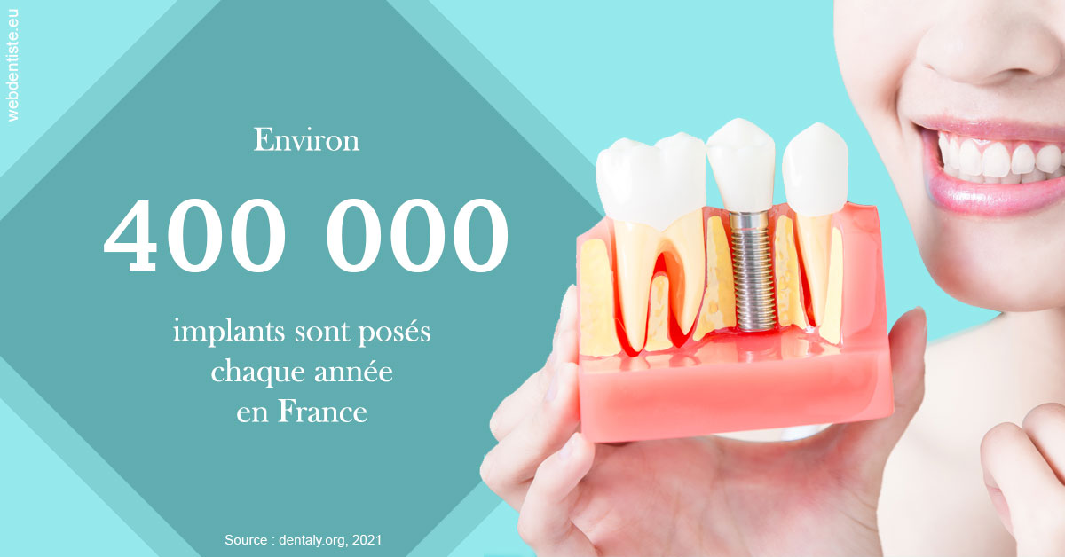 https://selarl-centre-dentaire-arceaux.chirurgiens-dentistes.fr/Pose d'implants en France 2